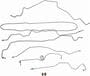 Dorman OE Solutions Brake Line Kit